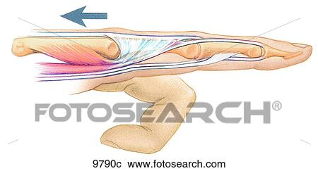 Clipart - Finger Extension Unlabeled. Fotosearch