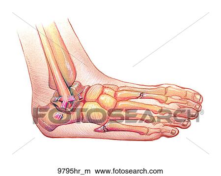 Foot with Stress and Avulsion Fracture and Sprain Unlabeled View Large Illustration Stock Illustration - Foot with Stress and Avulsion Fracture and Sprain Unlabeled. Fotosearch