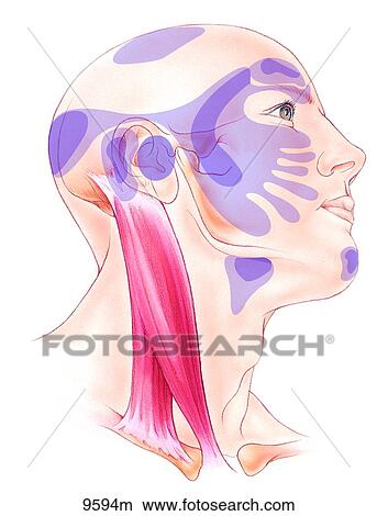 Stock Illustration - Head and Neck Trigger Points: Sternocleidomastoid Unlabeled. Fotosearch