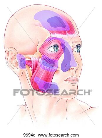 Stock Illustration - Head Trigger Points: Occipitofrontalis to Masseter Unlabeled. Fotosearch