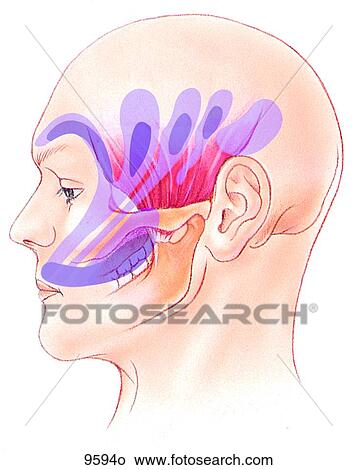 Head Trigger Points of Temporalis Unlabeled View Large Illustration Stock Illustration - Head Trigger Points of Temporalis Unlabeled. Fotosearch