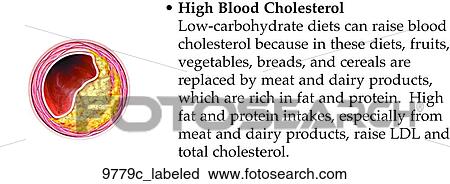 High Blood Cholesterol Icon Labeled View Large Illustration Clip Art - High Blood Cholesterol Icon Labeled. Fotosearch