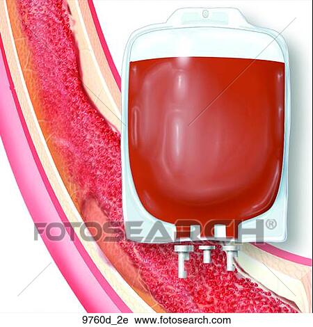 Icon for Blood and Blood Products Unlabeled View Large Illustration Clip Art - Icon for Blood and Blood Products Unlabeled. Fotosearch
