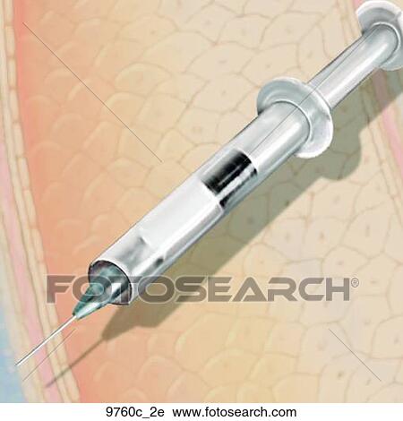 Clip Art - Icon for Hypodermic Needle Unlabeled. Fotosearch