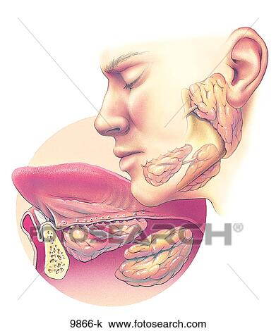 Drawing - Jaw Glandular Problems Unlabeled. Fotosearch