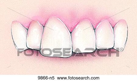 Macrodontia Unlabeled View Large Illustration Stock Illustration - Macrodontia Unlabeled. Fotosearch
