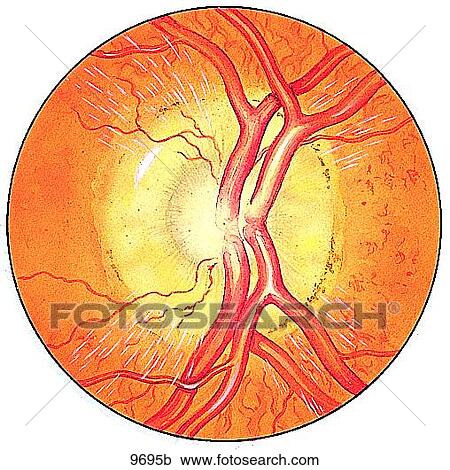 Normal Optic Disc Unlabeled View Large Illustration Clipart - Normal Optic Disc Unlabeled. Fotosearch