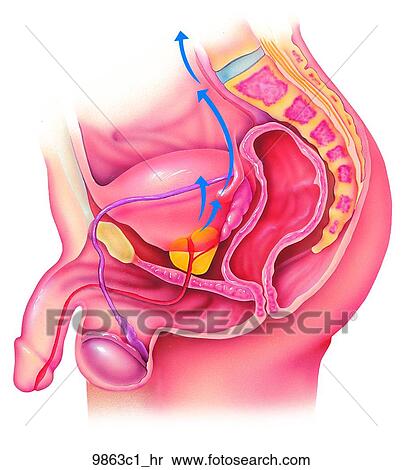 Pathways of Prostate Cancer Spread Unlabeled View Large Illustration Stock Illustration - Pathways of Prostate Cancer Spread Unlabeled. Fotosearch