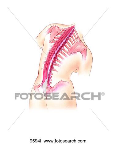 Posterior Torso Referred Pain: Iliocostalis Thoracis to Multifidi Unlabeled View Large Illustration Drawing - Posterior Torso Referred Pain: Iliocostalis Thoracis to Multifidi Unlabeled. Fotosearch