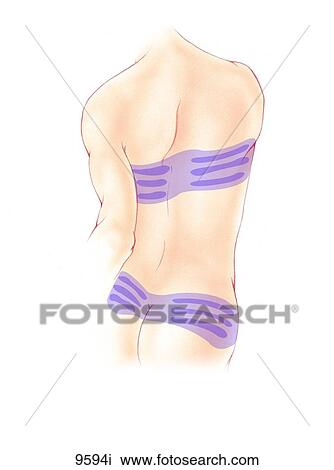 Drawing - Posterior Torso Referred Pain: Rectus Abdominus Unlabeled. Fotosearch