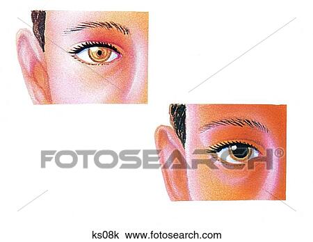 Pupil and iris. View Large Illustration Drawing - Pupil and iris.. Fotosearch
