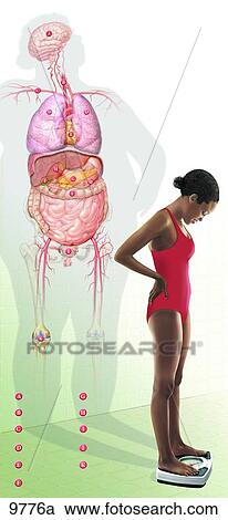 Clipart - Risks of Obesity Unlabeled. Fotosearch