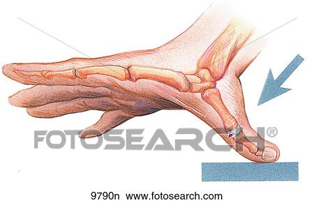 Skier's Thumb Unlabeled View Large Illustration Stock Illustration - Skier's Thumb Unlabeled. Fotosearch