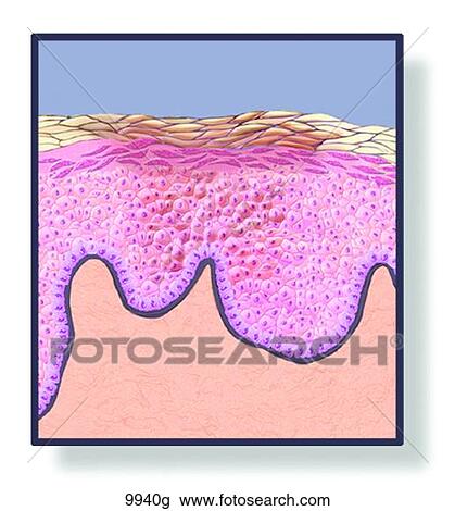 Skin Macule Unlabeled View Large Illustration Drawing - Skin Macule Unlabeled. Fotosearch