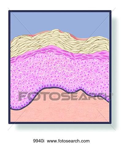 Skin Wheal Unlabeled View Large Illustration Drawing - Skin Wheal Unlabeled. Fotosearch