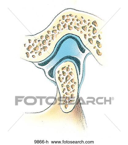 Drawing - TMJ Skeletal Jaw Opened Unlabeled. Fotosearch