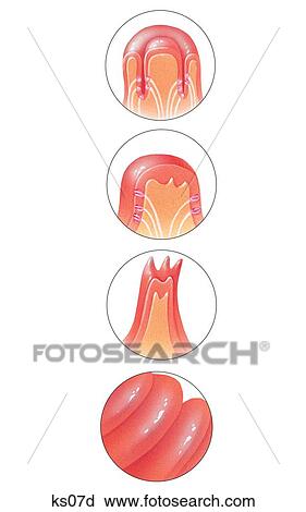 Clip Art - Types of Papillae: vallate, fungiform, filiform and foliate.. Fotosearch