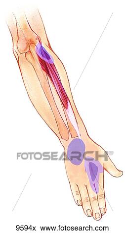 Upper Extremity Trigger Points: Extensor Carpi Radialis Brevis and Supinator Unlabeled View Large Illustration Stock Illustration - Upper Extremity Trigger Points: Extensor Carpi Radialis Brevis and Supinator Unlabeled. Fotosearch