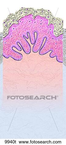 Verruca Vulgaris (Wart) Unlabeled View Large Illustration Stock Illustration - Verruca Vulgaris (Wart) Unlabeled. Fotosearch