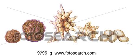 Vesicle Kidney Stones Unlabeled View Large Illustration Drawing - Vesicle Kidney Stones Unlabeled. Fotosearch