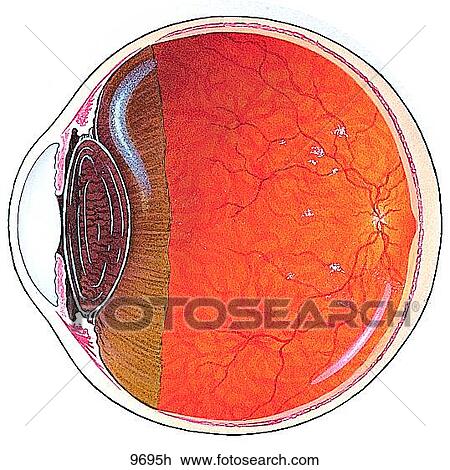 Vitreous Floaters Unlabeled View Large Illustration Drawing - Vitreous Floaters Unlabeled. Fotosearch
