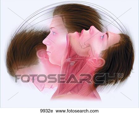Whiplash and TMJ Unlabeled View Large Illustration Clip Art - Whiplash and TMJ Unlabeled. Fotosearch