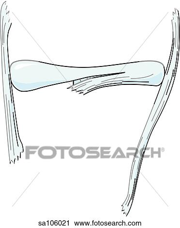 Clip Art - Anterior view of the knee joint showing the lateral and medial meniscus, fibular collateral ligament, tibial collateral ligament and transverse ligament.. Fotosearch