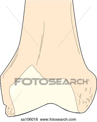 Anterior view of the knee joint showing the femur. View Large Illustration Stock Illustration - Anterior view of the knee joint showing the femur.. Fotosearch