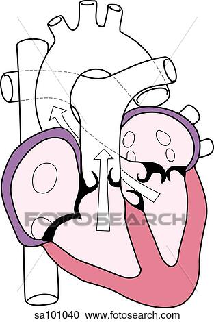 Clipart - Changes in heart structure during ventricular systole.. Fotosearch
