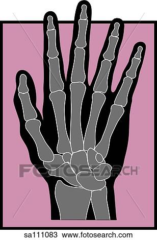 Graphic depiction of a hand with the bones visible to represent the skeletal system. View Large Illustration Drawing - Graphic depiction of a hand with the bones visible to represent the skeletal system.. Fotosearch
