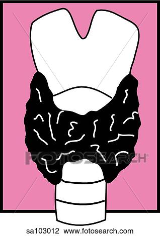 Graphic depiction of the thyroid gland upon the trachea. View Large Illustration Drawing - Graphic depiction of the thyroid gland upon the trachea.. Fotosearch