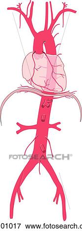 Stock Illustration - Heart and descending aorta.. Fotosearch