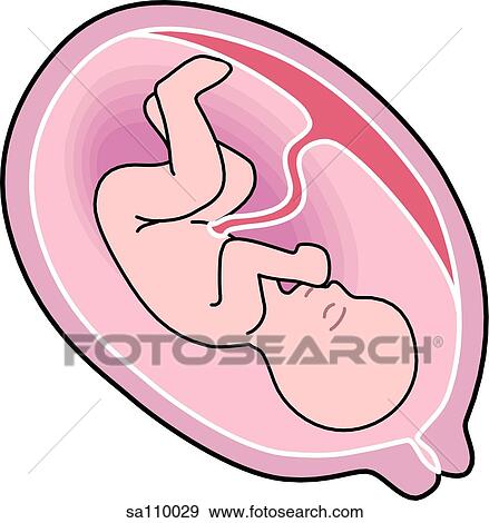 Lateral view of a pregnant woman showing expansion of uterus during the first trimester. View Large Illustration Stock Illustration - Lateral view of a pregnant woman showing expansion of uterus during the first trimester.. Fotosearch