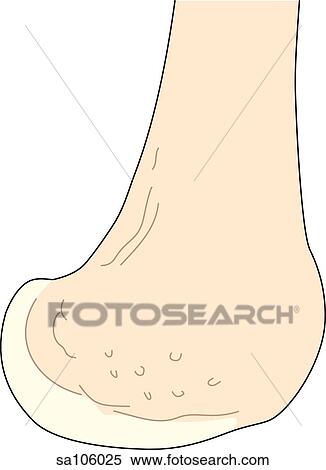 Stock Illustration - Lateral view of the knee joint showing the femur.. Fotosearch