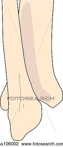 Drawing - Lateral view of the right ankle joint showing fibula and tibia.. Fotosearch