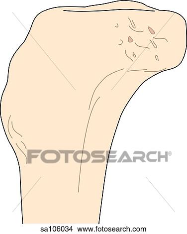 Stock Illustration - Medial view of the knee joint showing the tibia.. Fotosearch