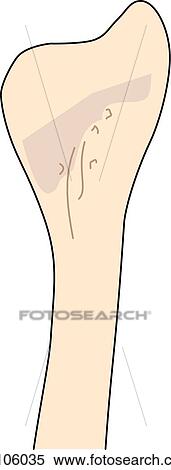 Medial view of the knee joint showing the fibula. View Large Illustration Stock Illustration - Medial view of the knee joint showing the fibula.. Fotosearch