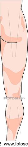 Drawing - Posterior view of the external anatomy of the right leg (gluteal region, thigh and calf).. Fotosearch