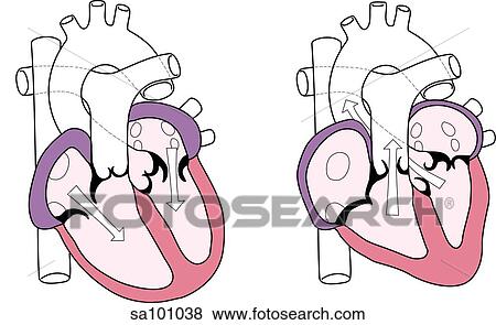 Stock Illustration - Two cross sections of the heart, side by side, showing the changes in heart structure during its pumping action.. Fotosearch