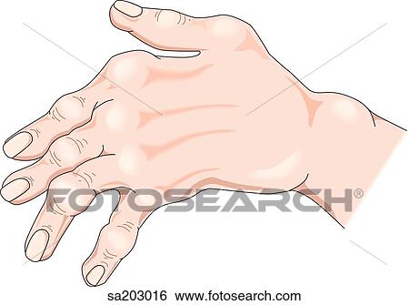 背である 光景 の 外部である 解剖学 の 進んだ 場合 の 関節炎 の 左 手 イラスト Sa3016 Fotosearch
