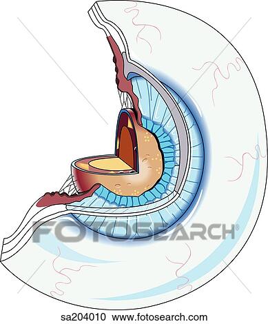 Clipart - Anterior view of eyeball with upper left quadrant cut away to reveal internal anatomy.. Fotosearch