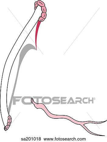 Stock Illustration - Coronary bypass. Right diversionary channel and branch of the right coronary artery.. Fotosearch