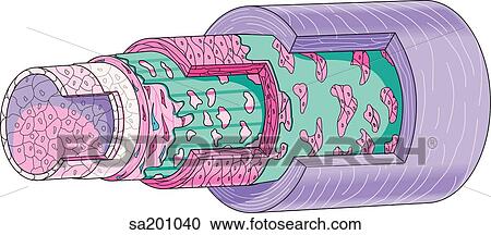Cutaway of an artery to reveal internal anatomy and muscle layers of wall. View Large Illustration Clipart - Cutaway of an artery to reveal internal anatomy and muscle layers of wall.. Fotosearch