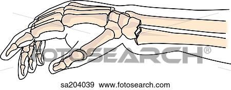 Epiphysial fracture of the radius. View Large Illustration Stock Illustration - Epiphysial fracture of the radius.. Fotosearch