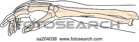 Greenstick fracture of the radius. View Large Illustration Stock Illustration - Greenstick fracture of the radius.. Fotosearch