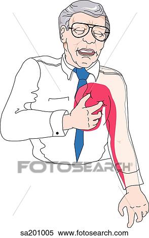Illustration of a man suffering from angina; pain pathway is indicated. View Large Illustration Stock Illustration - Illustration of a man suffering from angina; pain pathway is indicated.. Fotosearch