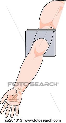 Orientation drawing of arm. View Large Illustration Drawing - Orientation drawing of arm.. Fotosearch