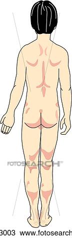 Drawing - Posterior view of the external anatomy of an Asian child.. Fotosearch