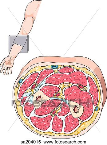 Querschnitt, von, unterarm, an, wasserwaage, mittelstraße, zwischen
