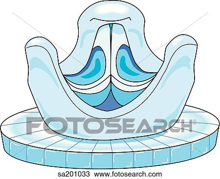 Stented tissue valve. View Large Illustration Drawing - Stented tissue valve.. Fotosearch